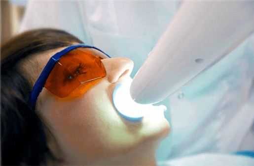 Understanding the Causes of Teeth Sensitivity Oxford