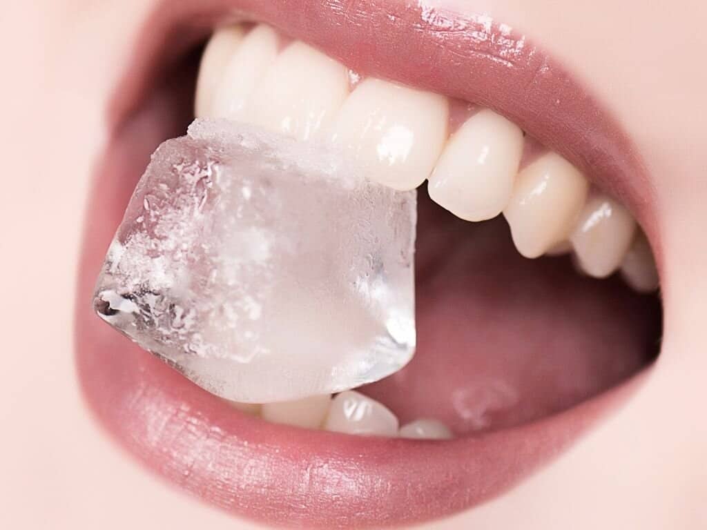 When to Combine Diet with Professional Teeth Whitening Treatments Oxford