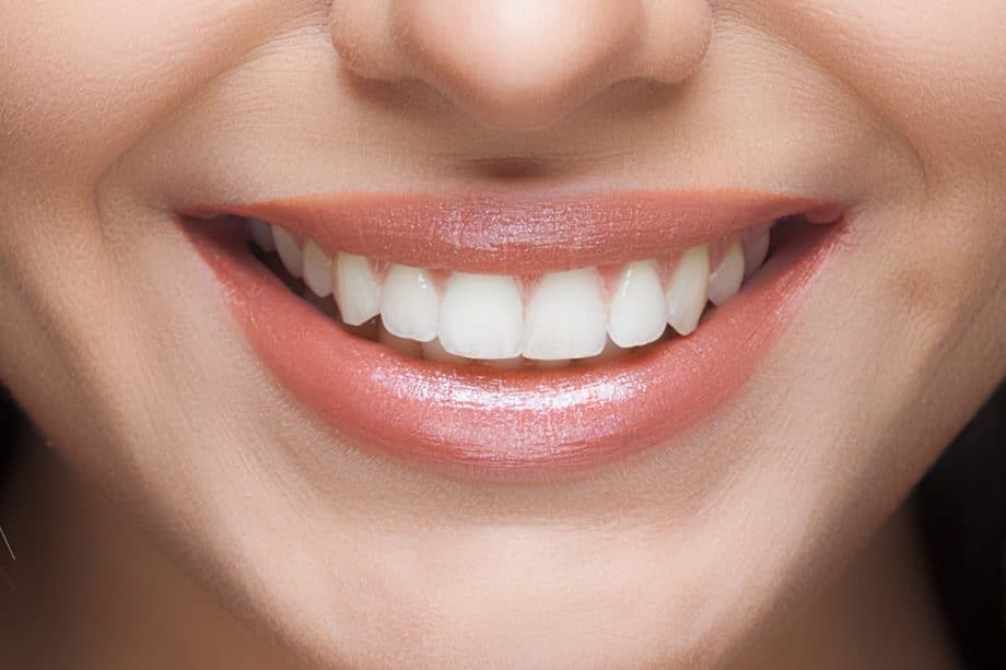 The Role of a Balanced Diet in Long-Term Whitening Results Oxford