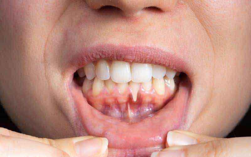 Final Thoughts: Building Lifelong Enamel Protection Habits Oxford