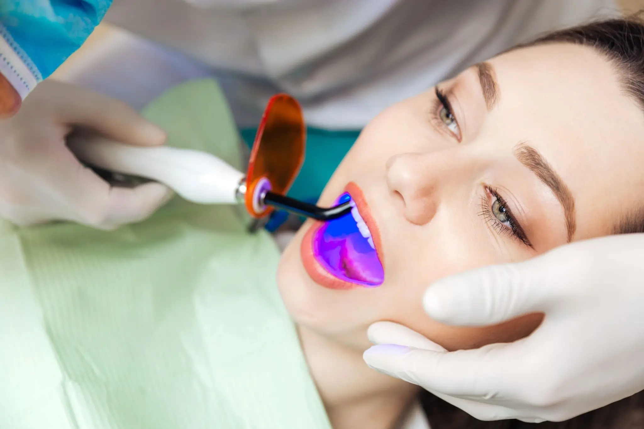 Is Laser Teeth Whitening Safe and Effective Oxford?