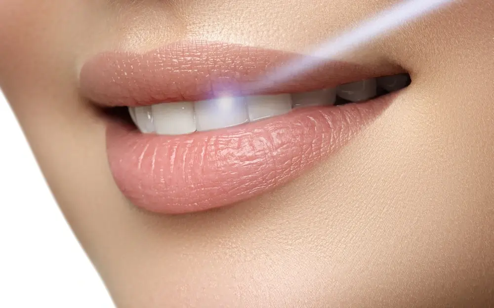 What Are Simple Ways to Improve the Look of Your Smile Oxford?