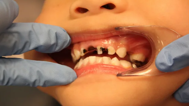 Tips for Keeping Your Child’s Baby Teeth Healthy and Strong Oxford