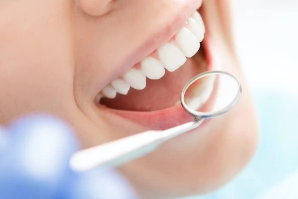 How to Maintain Your Whiter Smile After Treatment Oxford