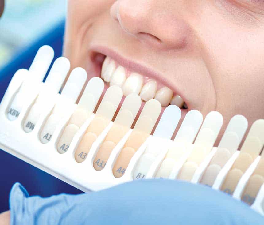 Is Laser Teeth Whitening Worth It for a Brighter, Confident Smile Oxford?