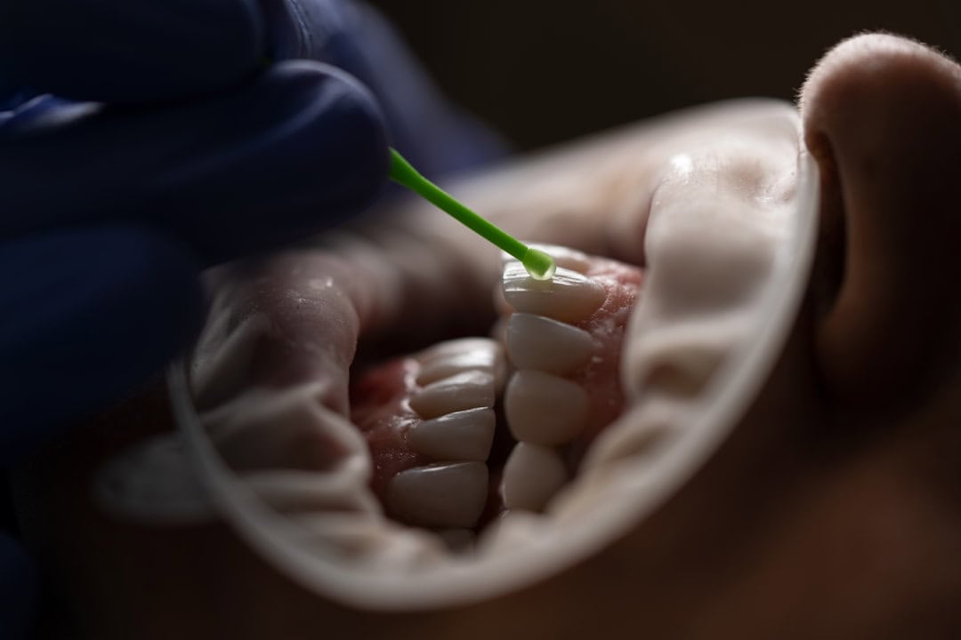 How Saliva Protects Your Teeth and Gums Oxford