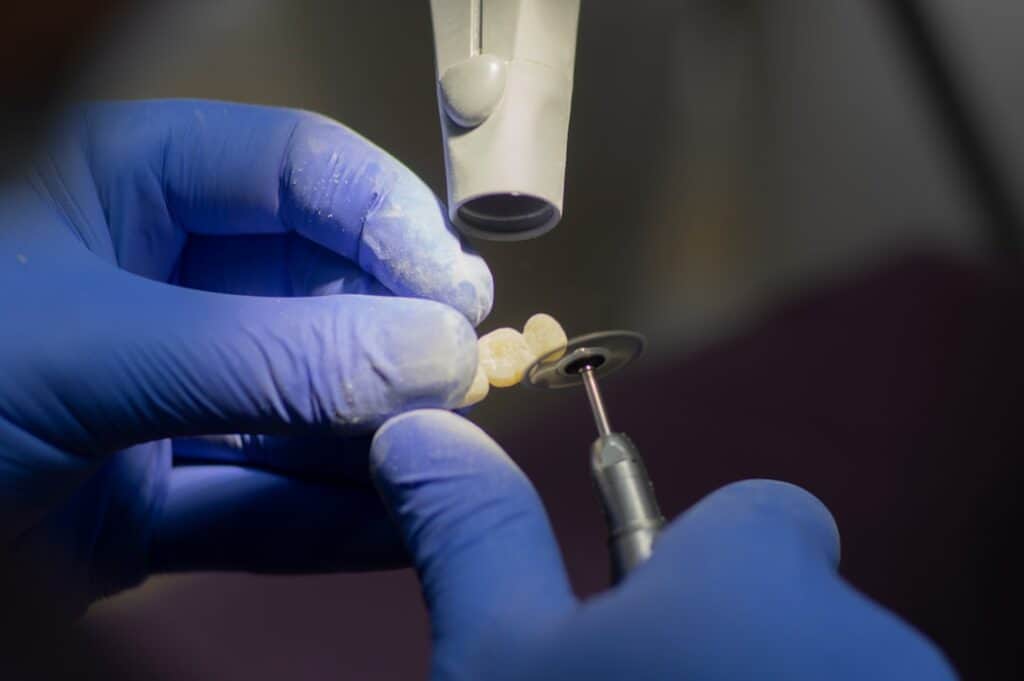 Customised Dental Solutions: Crowns, Aligners, and Implants Oxford