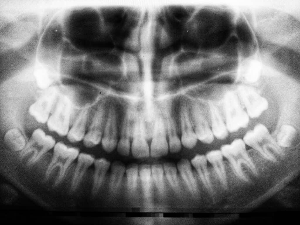 The Future of 3D Printing in Oral Healthcare Oxford